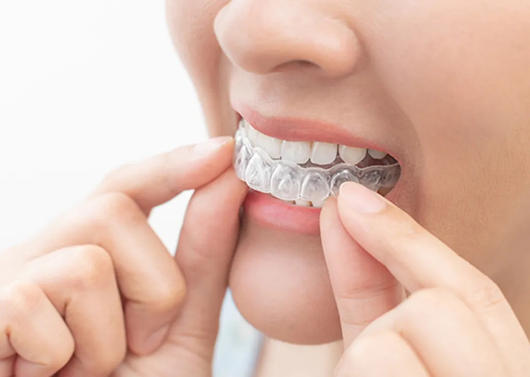 複雑な歯並びでも、部分矯正や補助装置を活用して柔軟に対応・改善