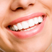 歯の矯正、セラミック治療