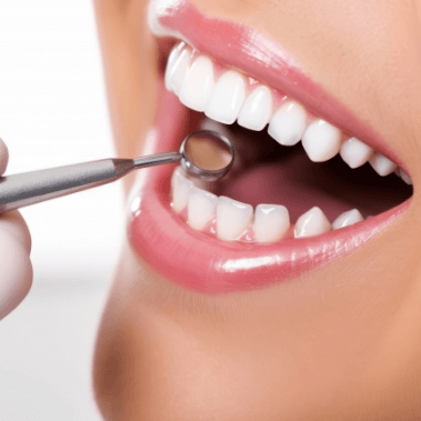 噛み合わせの安定と虫歯の再発を防ぐため、セラミック治療後のメンテナンスを重視しています