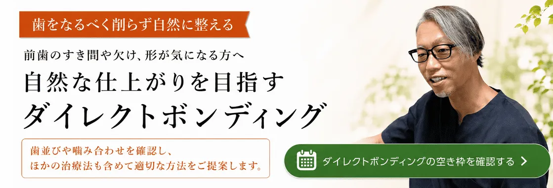 ダイレクトボンディングのバナー