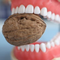 硬い食べ物を前歯で噛む