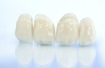 セラミッククラウン