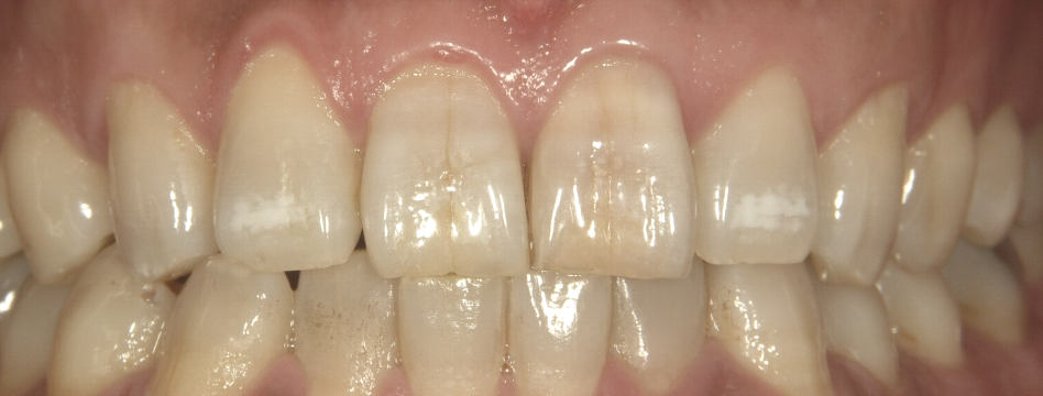 自分の口元に自信がありますか