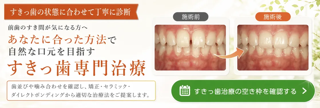 すきっ歯専門治療のバナー