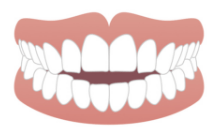 下の歯が前に出ている（受け口）