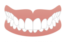 上下の歯が噛み合わない（開咬）