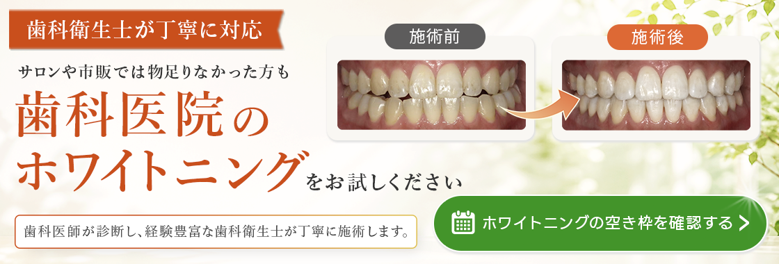 ホワイトニングのバナー