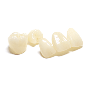 セラミッククラウン　差し歯